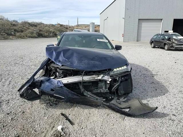 2015 Acura TLX - zdjęcie 13