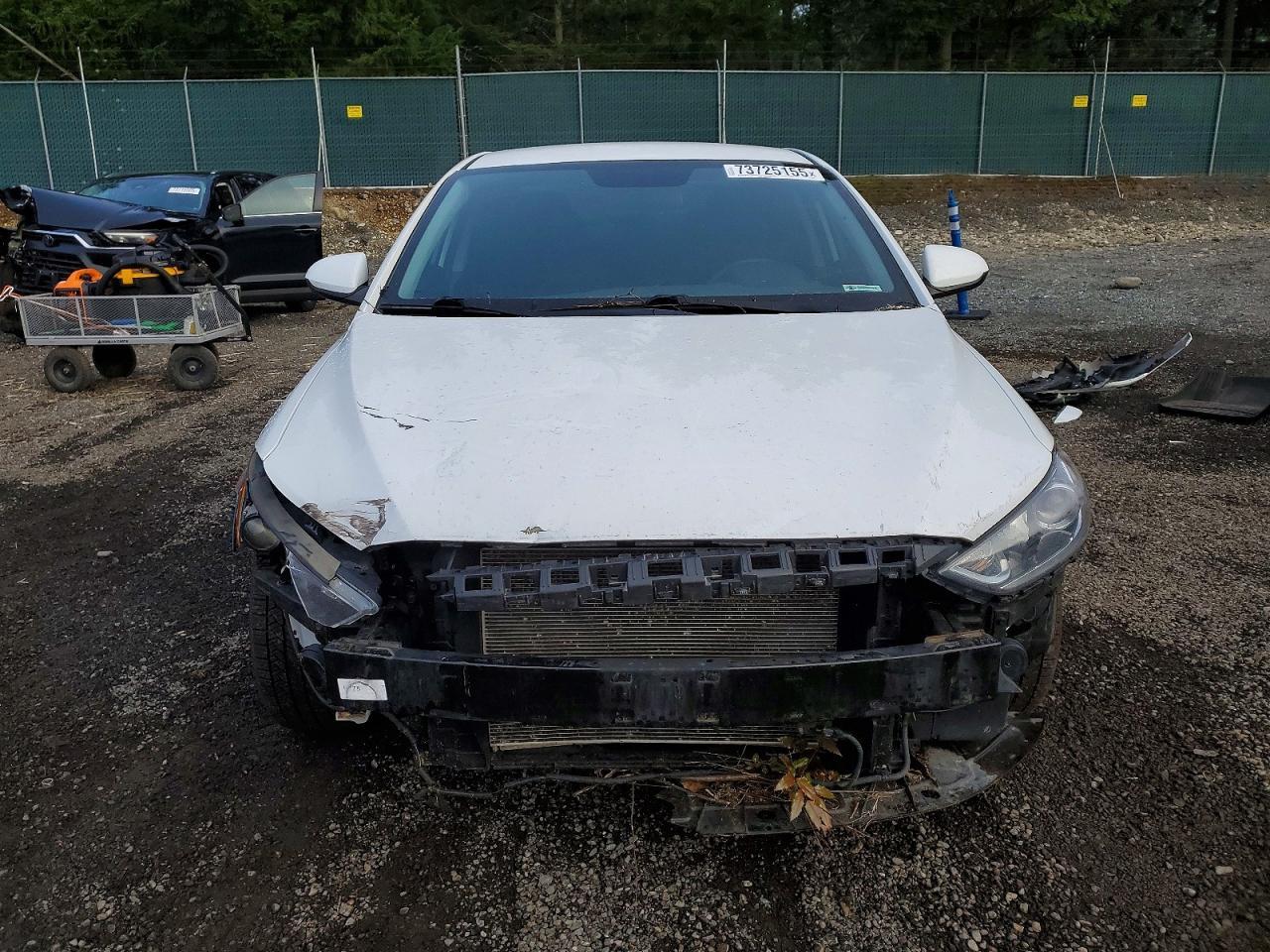 2018 Hyundai Elantra Sel - zdjęcie 5