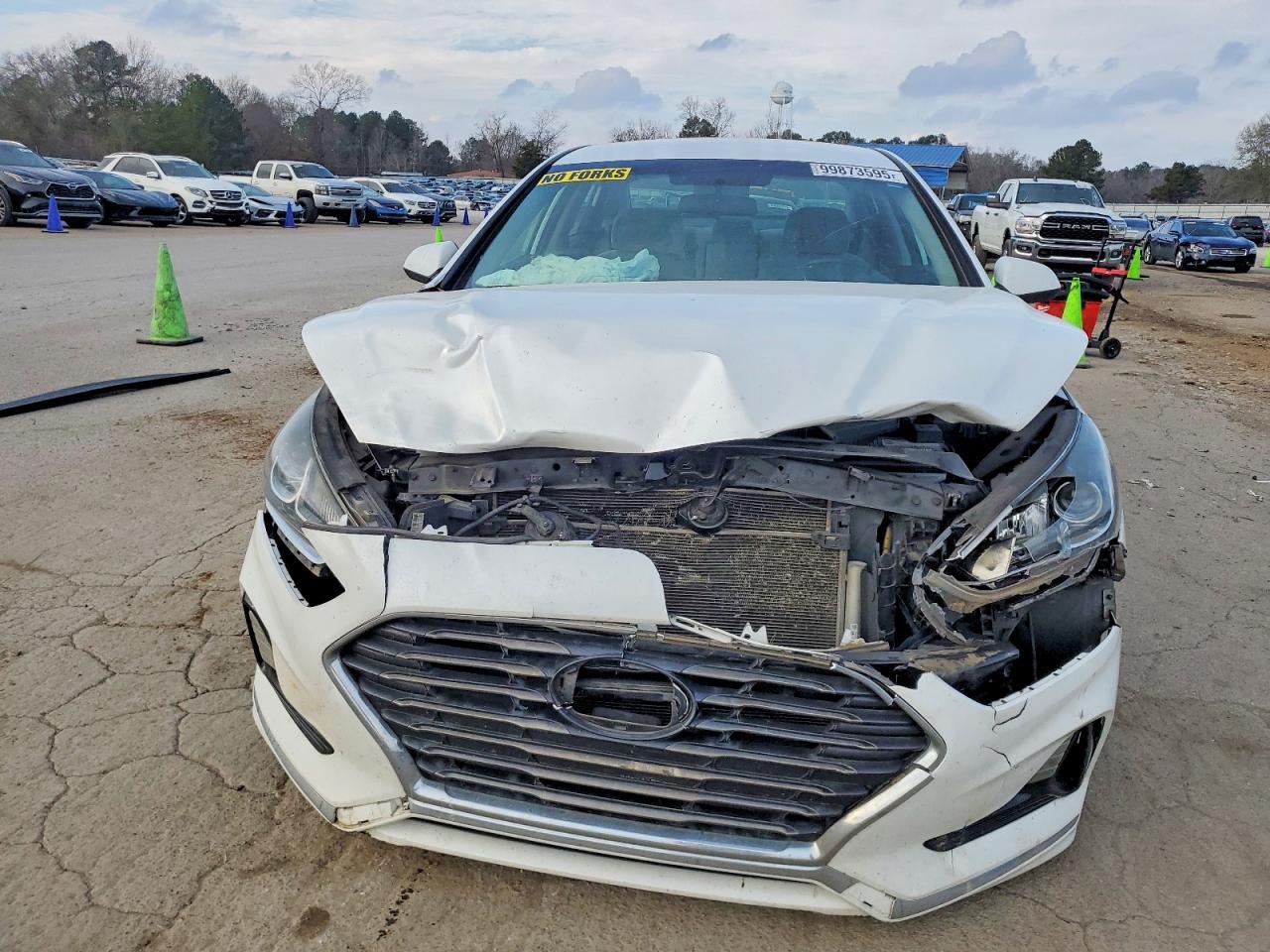 2018 Hyundai Sonata Se - zdjęcie 5