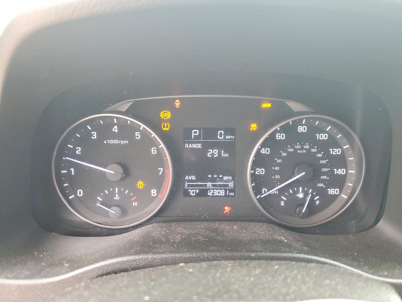 2017 Hyundai Elantra Se - zdjęcie 9