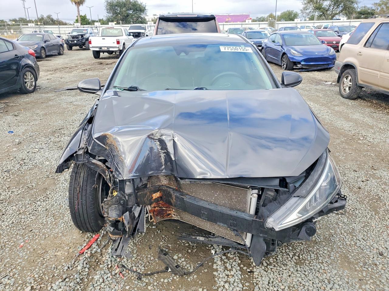 2020 Hyundai Elantra Sel - zdjęcie 5