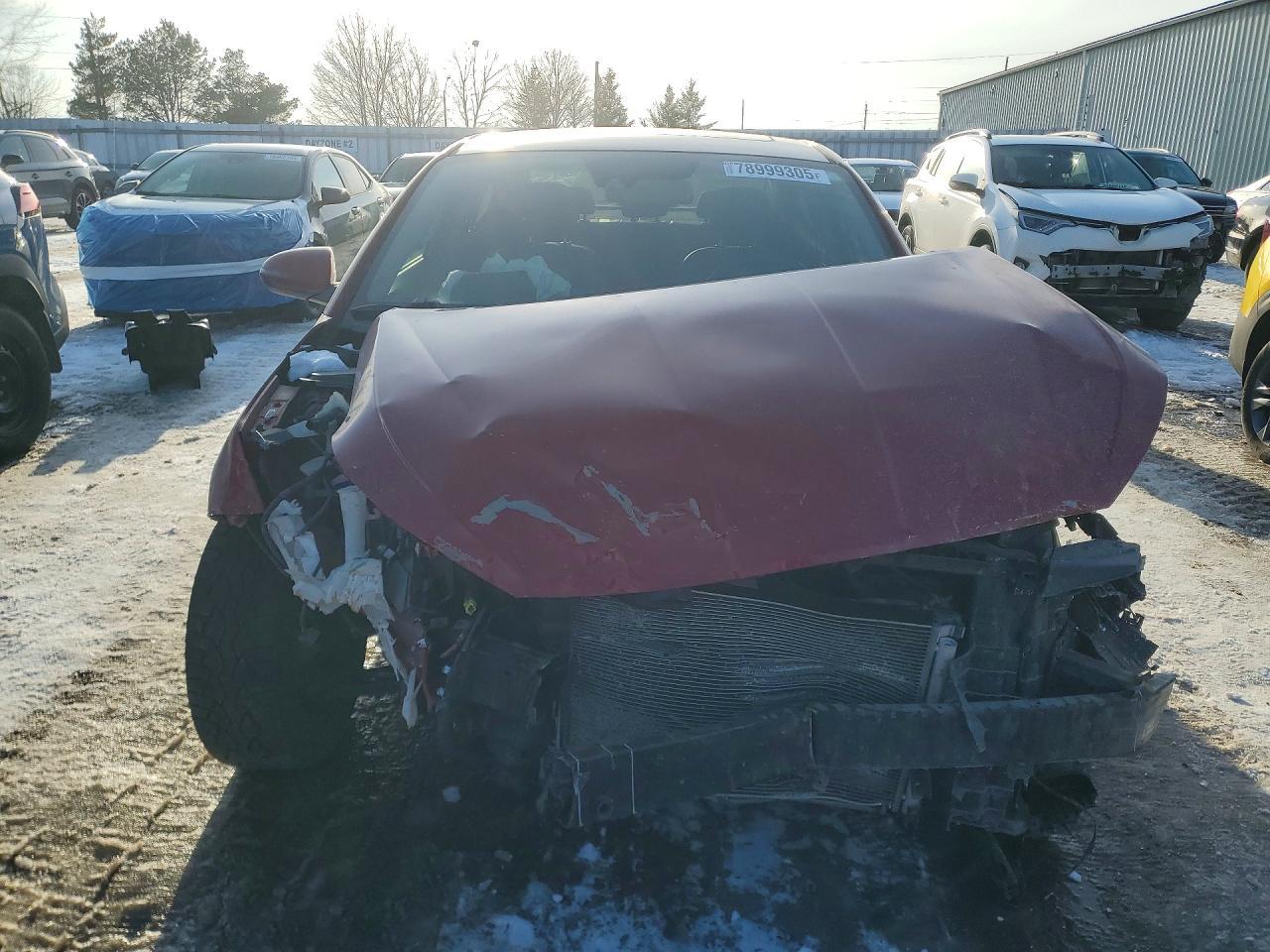 2020 Hyundai Elantra Sel - zdjęcie 5