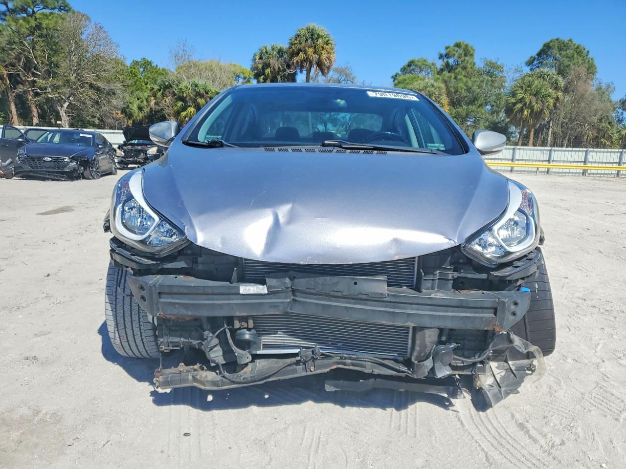 2016 Hyundai Elantra Limited - zdjęcie 5