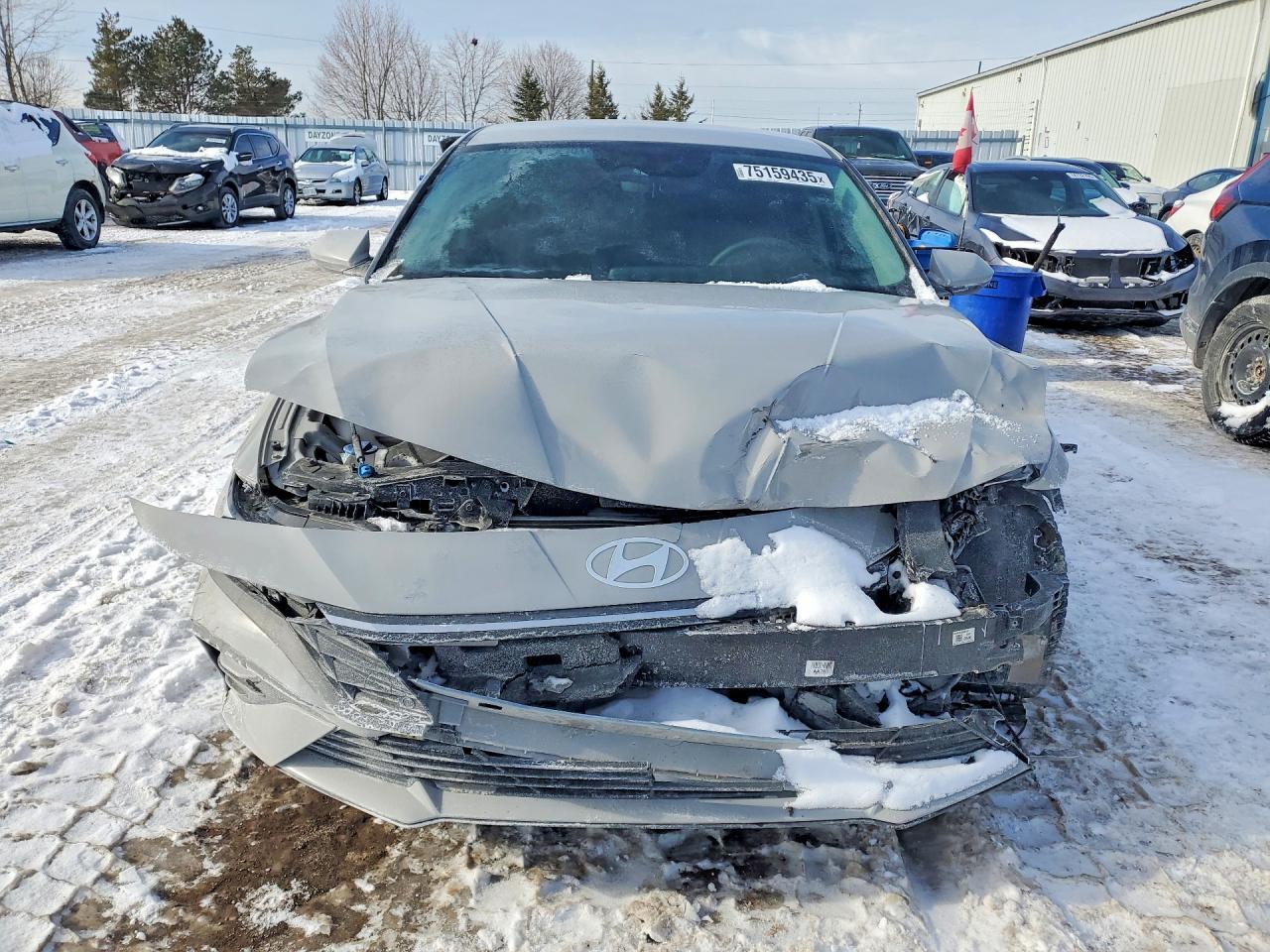 2024 Hyundai Elantra Sel - zdjęcie 5