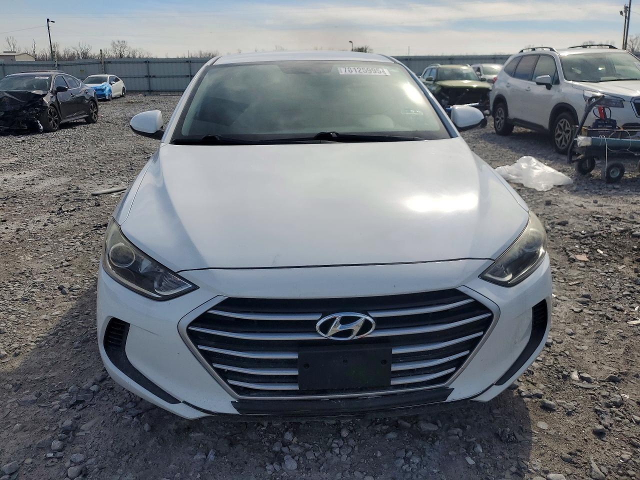 2017 Hyundai Elantra Se - zdjęcie 5
