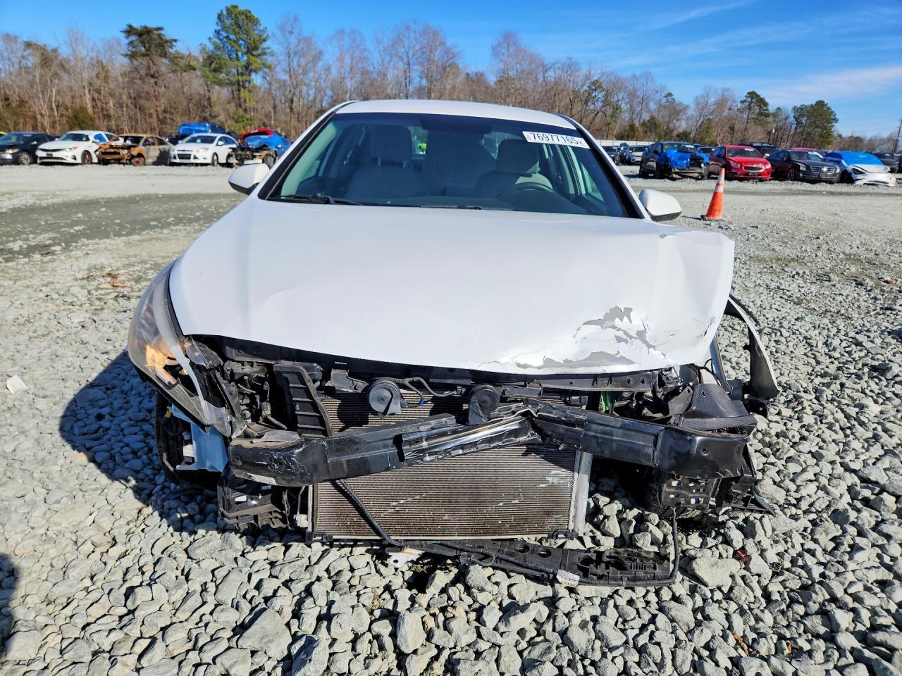 2017 Hyundai Sonata Se - zdjęcie 5