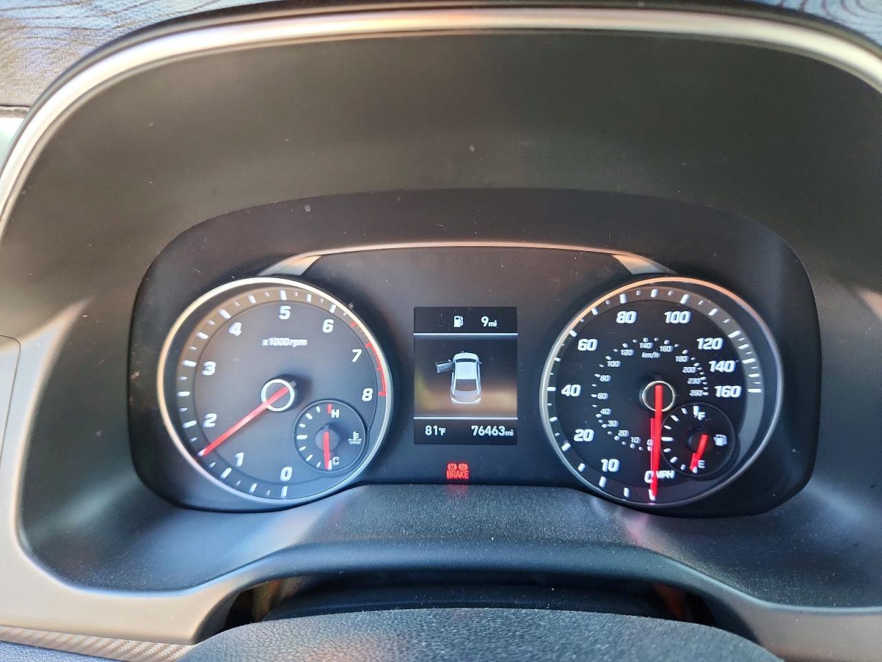 2019 Hyundai Elantra Sport - zdjęcie 9