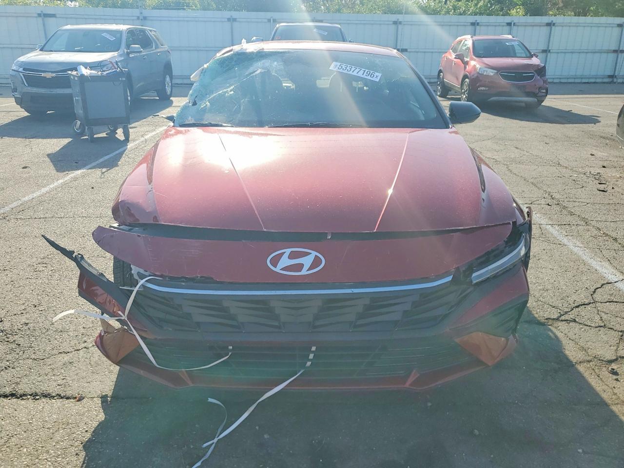 2025 Hyundai Elantra Sel Sport - zdjęcie 5