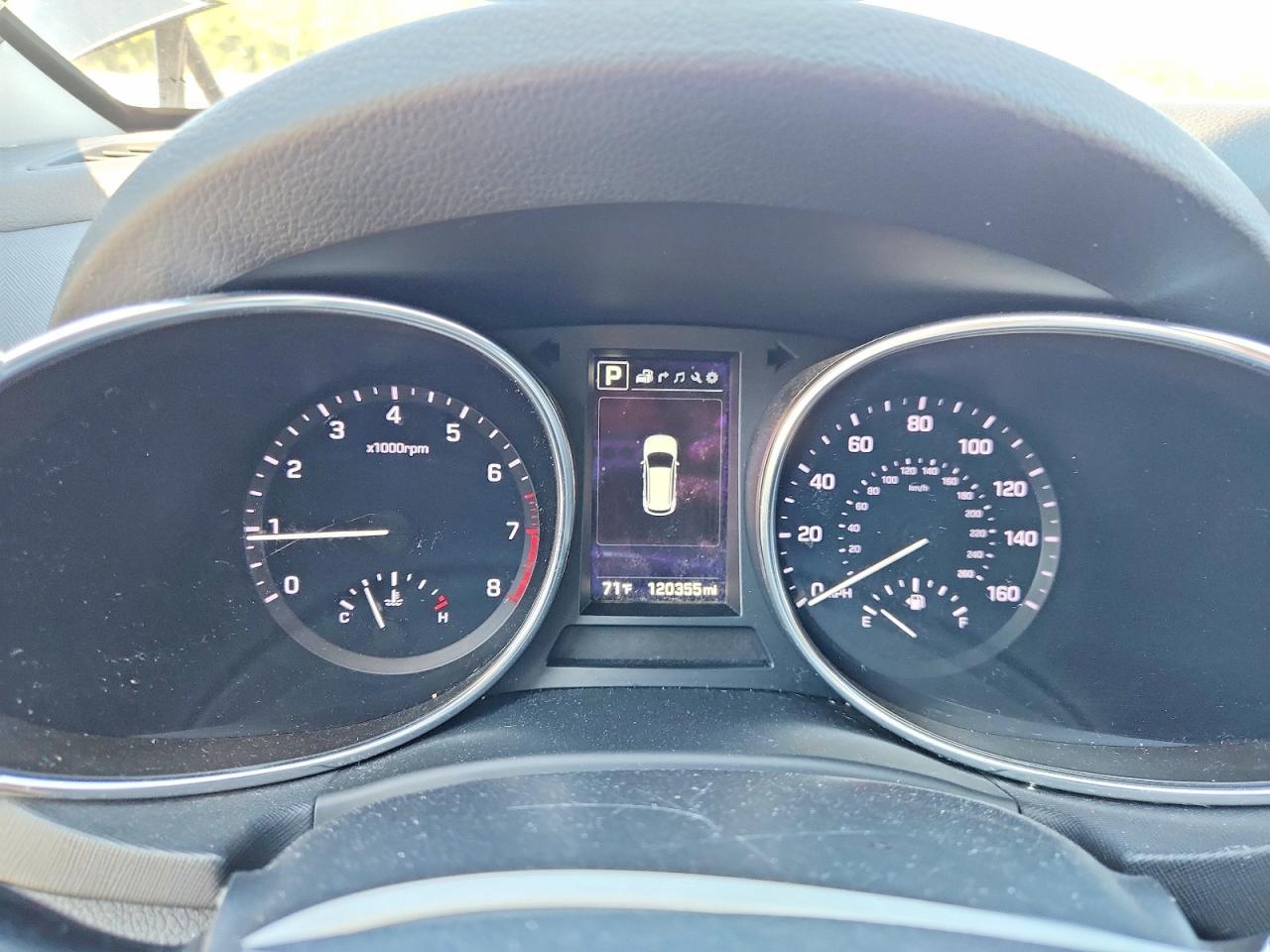 2017 Hyundai Santa Fe Sport 2.0T Ultimate - zdjęcie 9