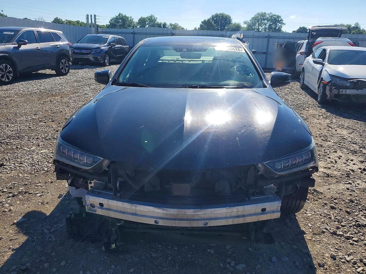 2018 Acura Tlx - zdjęcie 5
