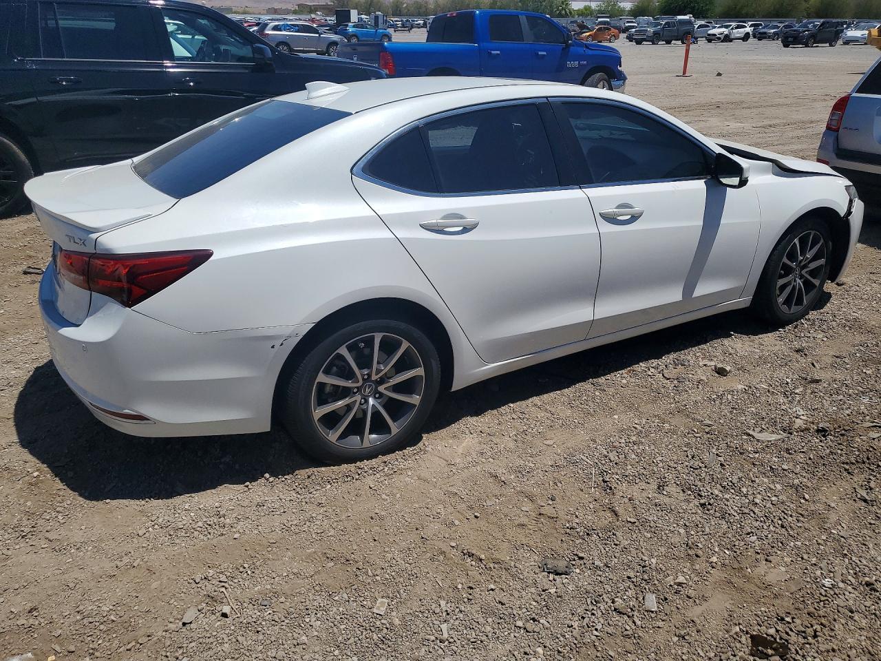 2015 Acura Tlx Advance - zdjęcie 3