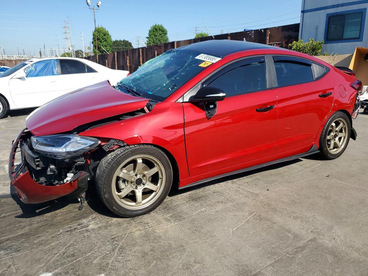 2017 Hyundai Elantra Limited - zdjęcie główne