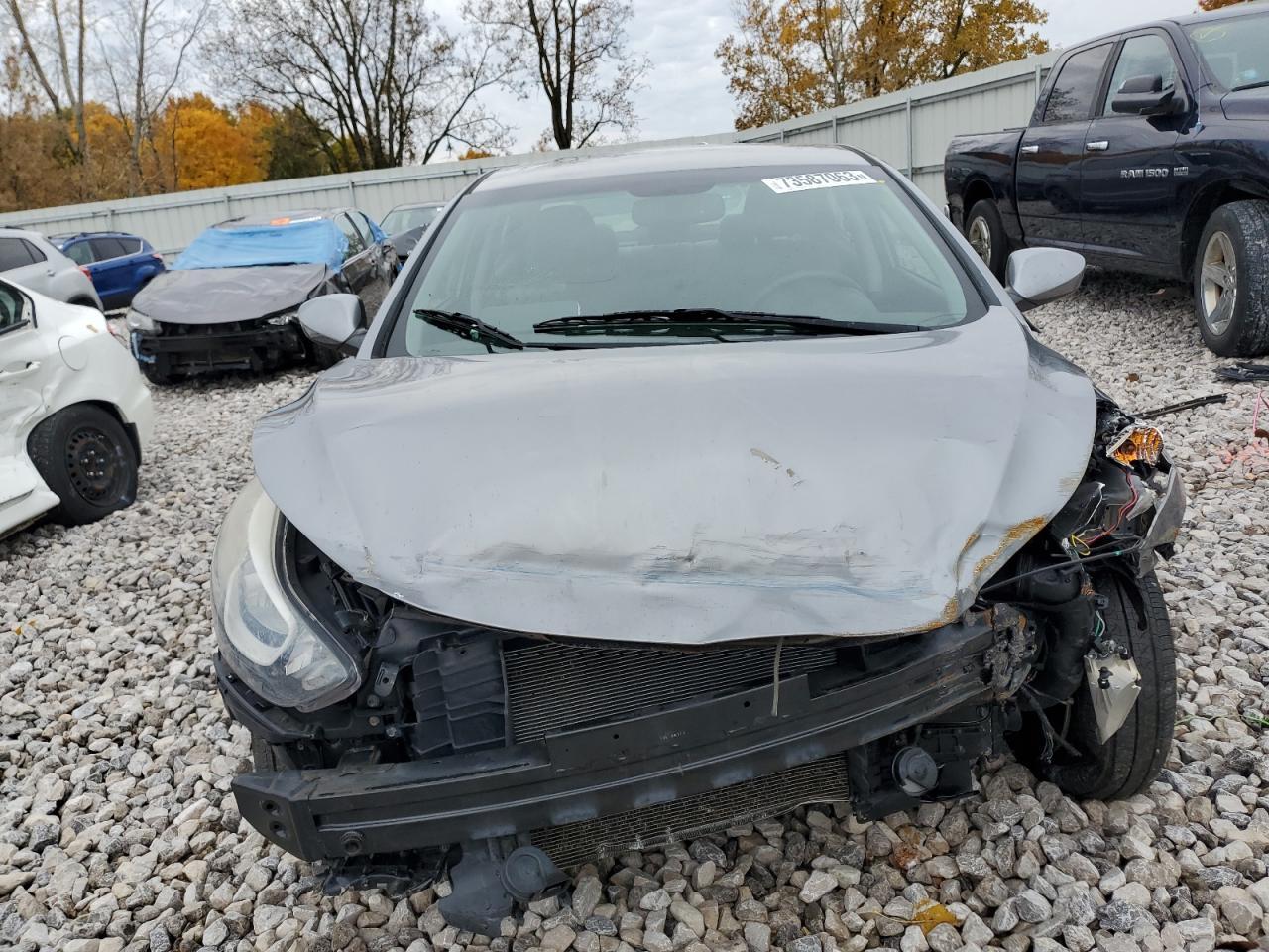 2015 Hyundai Elantra Se - zdjęcie 5