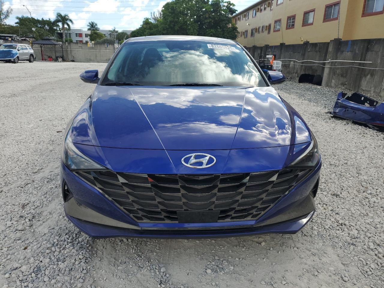 2022 Hyundai Elantra Limited - zdjęcie 5