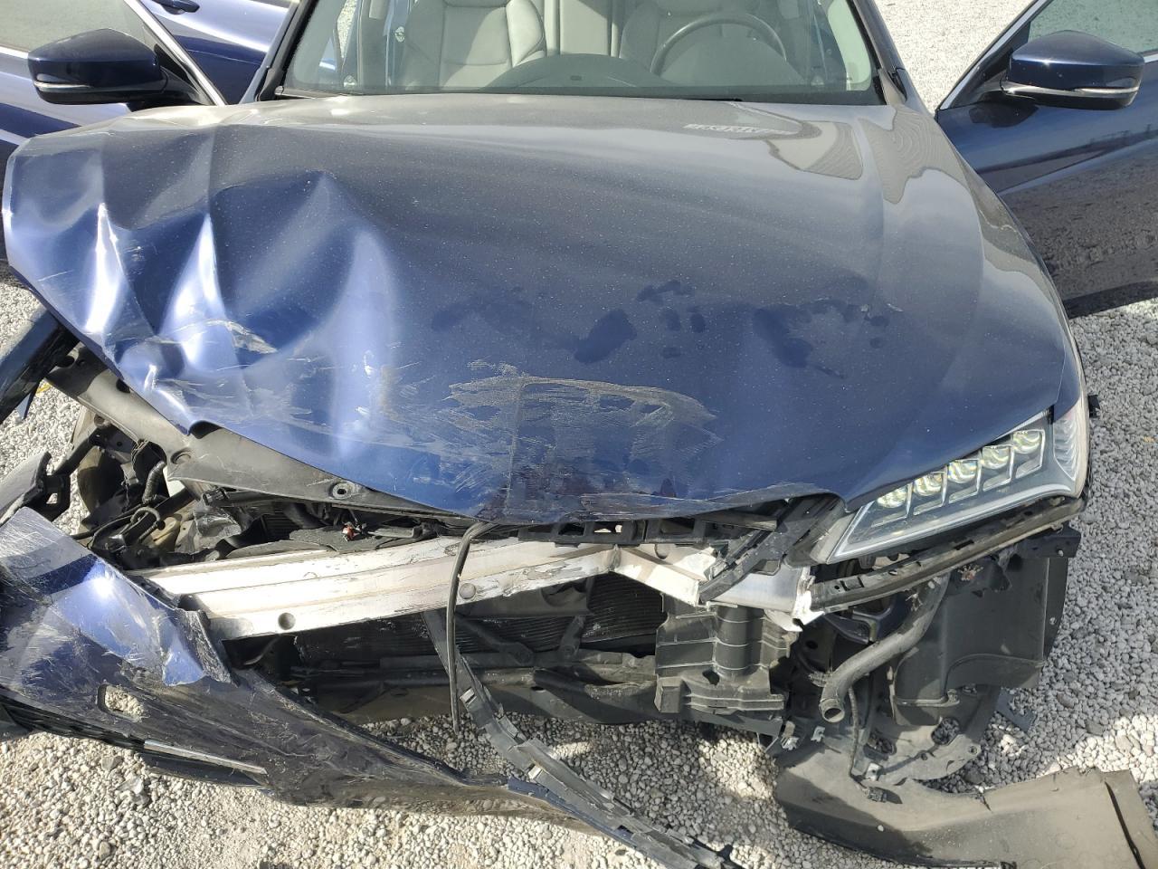 2015 Acura TLX - zdjęcie 11