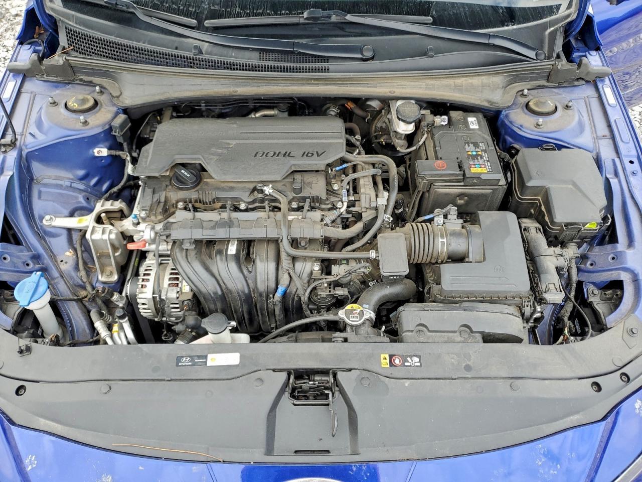 2024 Hyundai Elantra Sel - zdjęcie 11